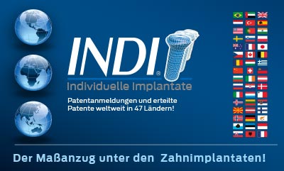 INDI,erteilte Patente weltweit